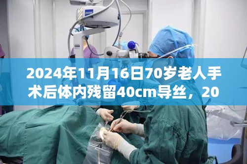 医疗技术革新下的遗留问题，70岁老人手术后体内遗留长达40cm导丝深度评测与反思